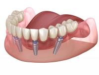 Cosmetic & Laser Dentistry Centre image 1